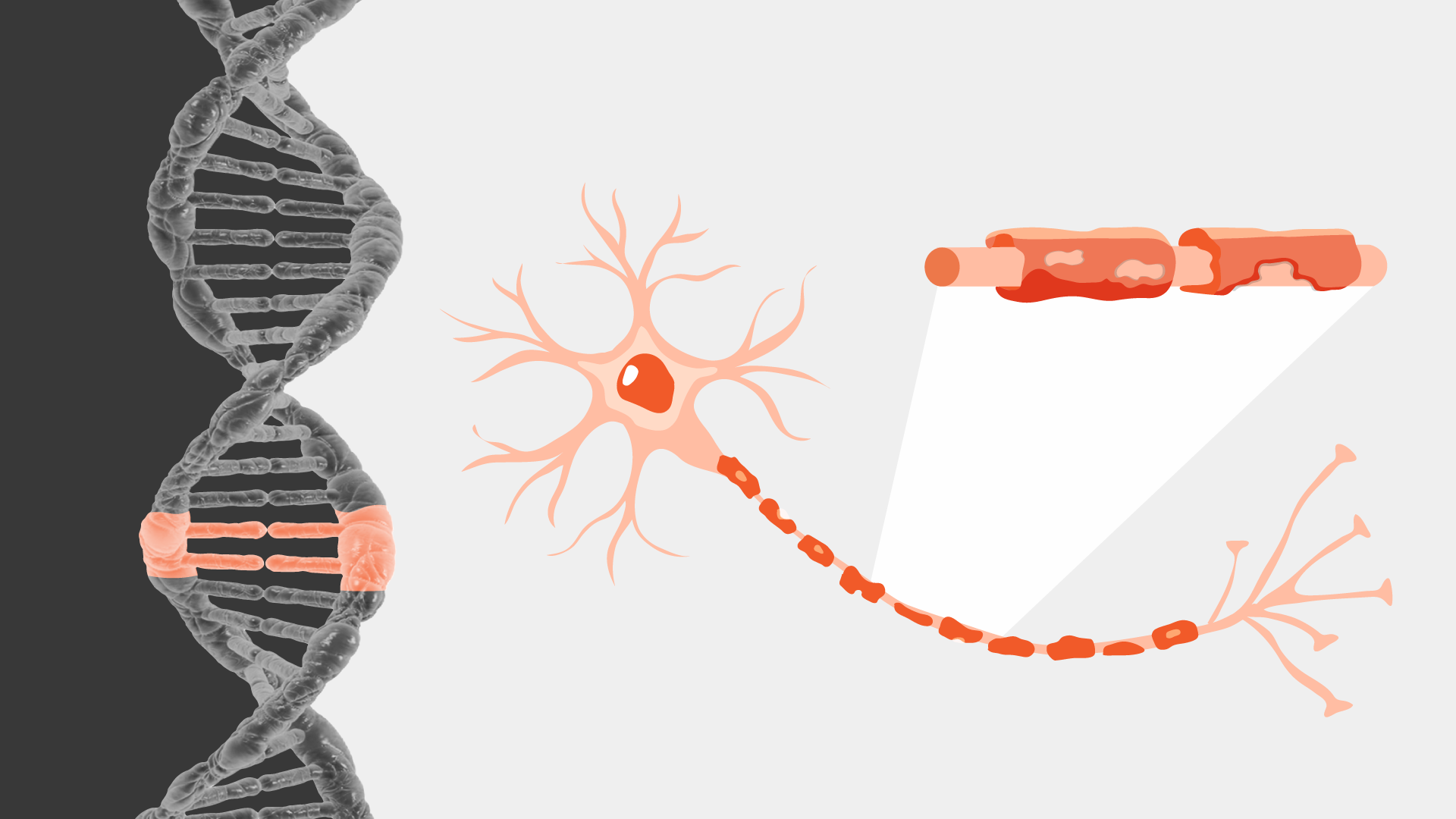 Ilustração de um DNA com mutação genética e um neurônio com bainha de mielina degenerada pela doença adrenoleucodistrofia